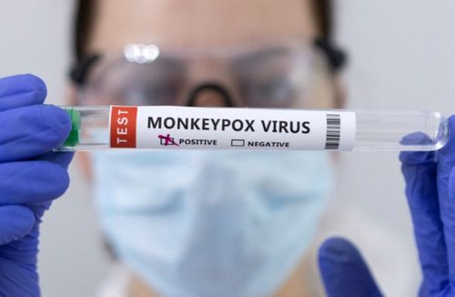 107065668-16533303872022-05-23t182141z_475247910_rc25du95s1nl_rtrmadp_0_health-monkeypox.jpeg